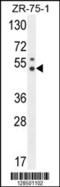 Pseudouridine Synthase 3 antibody, 55-454, ProSci, Western Blot image 