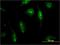 Calpain 15 antibody, H00006650-M05, Novus Biologicals, Immunocytochemistry image 