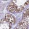 SURP And G-Patch Domain Containing 2 antibody, NBP1-87868, Novus Biologicals, Immunohistochemistry frozen image 