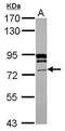 Tyrosine-protein kinase Tec antibody, PA5-29419, Invitrogen Antibodies, Western Blot image 