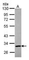 Poly(ADP-Ribose) Polymerase Family Member 11 antibody, GTX107210, GeneTex, Western Blot image 