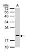 Regulator Of G Protein Signaling 13 antibody, PA5-22291, Invitrogen Antibodies, Western Blot image 