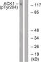 ACK1 antibody, 79-795, ProSci, Western Blot image 