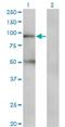 Transporter 1, ATP Binding Cassette Subfamily B Member antibody, H00006890-M03, Novus Biologicals, Western Blot image 