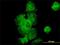 Dynactin Subunit 2 antibody, H00010540-M01, Novus Biologicals, Immunocytochemistry image 