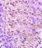 Cathepsin B antibody, orb10249, Biorbyt, Immunohistochemistry paraffin image 