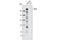 GLI Family Zinc Finger 2 antibody, 2585S, Cell Signaling Technology, Western Blot image 