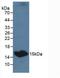 Thyroid Stimulating Hormone Subunit Beta antibody, LS-C687759, Lifespan Biosciences, Western Blot image 