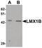 LIM homeobox transcription factor 1-beta antibody, PA5-34471, Invitrogen Antibodies, Western Blot image 