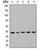 Phosphatase And Tensin Homolog antibody, orb382640, Biorbyt, Western Blot image 