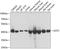 Glutamic-Oxaloacetic Transaminase 2 antibody, GTX55645, GeneTex, Western Blot image 