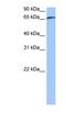 Rab Geranylgeranyltransferase Subunit Alpha antibody, NBP1-55183, Novus Biologicals, Western Blot image 