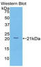 IL-12 antibody, LS-C301722, Lifespan Biosciences, Western Blot image 