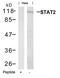 Signal Transducer And Activator Of Transcription 2 antibody, GTX50661, GeneTex, Western Blot image 