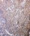 C-X-C Motif Chemokine Receptor 6 antibody, PA2082, Boster Biological Technology, Immunohistochemistry frozen image 