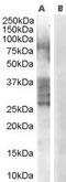 ADAM Metallopeptidase Domain 33 antibody, PA5-18379, Invitrogen Antibodies, Western Blot image 