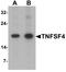 TNF Superfamily Member 4 antibody, LS-B10083, Lifespan Biosciences, Western Blot image 