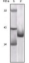 Cyclin Dependent Kinase Inhibitor 2A antibody, A00016-3, Boster Biological Technology, Western Blot image 