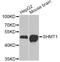 Serine Hydroxymethyltransferase 1 antibody, A12489, ABclonal Technology, Western Blot image 