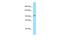 RNA Binding Motif Protein 25 antibody, A07494, Boster Biological Technology, Western Blot image 