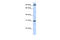 Ankyrin Repeat Family A Member 2 antibody, 26-557, ProSci, Western Blot image 