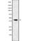 GDP-Mannose 4,6-Dehydratase antibody, abx215645, Abbexa, Western Blot image 