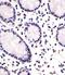 FEV Transcription Factor, ETS Family Member antibody, M03460, Boster Biological Technology, Immunohistochemistry paraffin image 