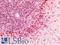 Cathepsin D antibody, LS-B16508, Lifespan Biosciences, Immunohistochemistry paraffin image 