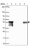 Dystrobrevin Beta antibody, NBP2-38915, Novus Biologicals, Western Blot image 