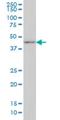 Distal-Less Homeobox 2 antibody, H00001746-M04, Novus Biologicals, Western Blot image 