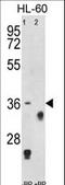 TNF Receptor Superfamily Member 14 antibody, LS-C162063, Lifespan Biosciences, Western Blot image 