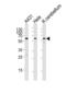 KISS1 Receptor antibody, LS-C203793, Lifespan Biosciences, Western Blot image 