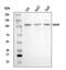 Adenosine Deaminase RNA Specific antibody, A00869-2, Boster Biological Technology, Western Blot image 