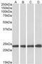 Superoxide Dismutase 2 antibody, MBS422763, MyBioSource, Western Blot image 