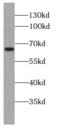 HMG-Box Containing 4 antibody, FNab03934, FineTest, Western Blot image 