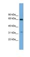 UBX Domain Protein 10 antibody, orb325806, Biorbyt, Western Blot image 