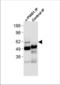 Protein Inhibitor Of Activated STAT 1 antibody, TA302212, Origene, Western Blot image 