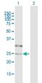 Collectrin, Amino Acid Transport Regulator antibody, H00057393-B01P, Novus Biologicals, Western Blot image 