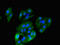 Histamine Receptor H1 antibody, LS-C678246, Lifespan Biosciences, Immunofluorescence image 
