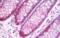 T Cell Lymphoma Invasion And Metastasis 1 antibody, orb314028, Biorbyt, Western Blot image 