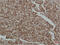 SMAD Family Member 3 antibody, GTX34208, GeneTex, Immunohistochemistry paraffin image 