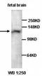 Protein Kinase AMP-Activated Non-Catalytic Subunit Beta 1 antibody, orb77066, Biorbyt, Western Blot image 