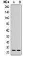 Carbonyl Reductase 4 antibody, LS-C668397, Lifespan Biosciences, Western Blot image 