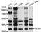 Tissue Specific Transplantation Antigen P35B antibody, STJ26557, St John