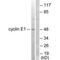 Cyclin E1 antibody, A00543-1, Boster Biological Technology, Western Blot image 