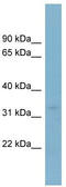 NECAP Endocytosis Associated 2 antibody, TA344928, Origene, Western Blot image 