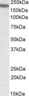 Integrin Subunit Alpha L antibody, GTX88390, GeneTex, Western Blot image 