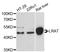 Lecithin Retinol Acyltransferase antibody, LS-C748234, Lifespan Biosciences, Western Blot image 