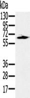 Heat Shock Transcription Factor 2 antibody, TA323864, Origene, Western Blot image 