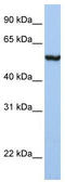 Solute Carrier Family 39 Member 5 antibody, TA334618, Origene, Western Blot image 